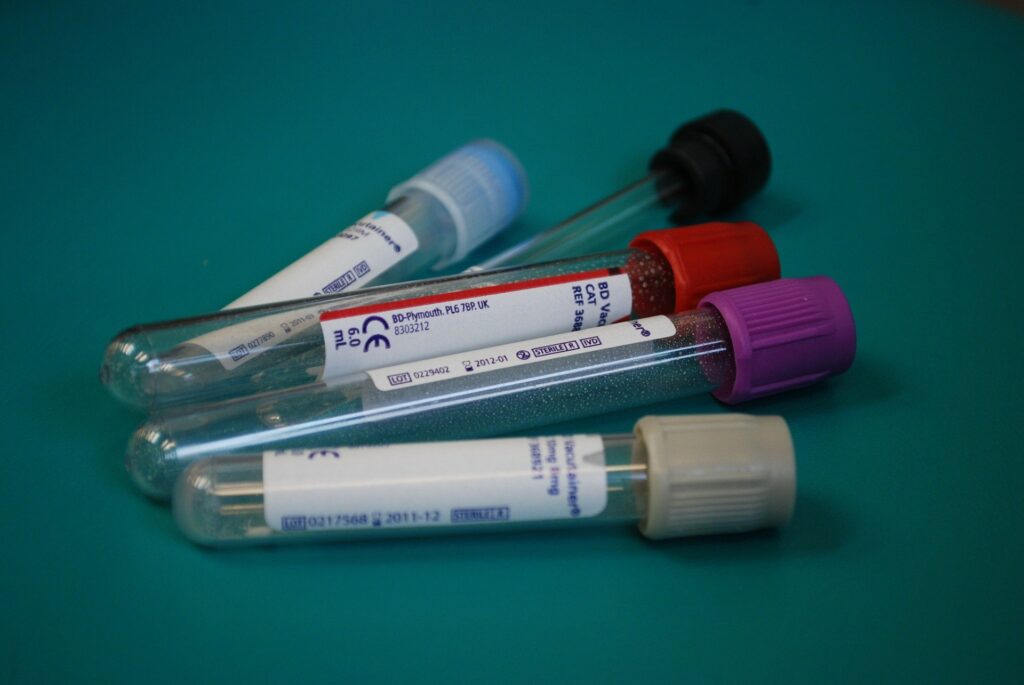 Febrero: evaluación de nuevos tratamientos y seguimiento del virus